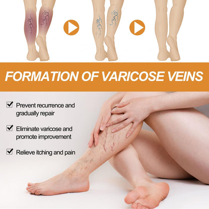 Turmeric Varicose Vein Relief Spray( BUY 1 GET 2 FREE💥 🎁  )