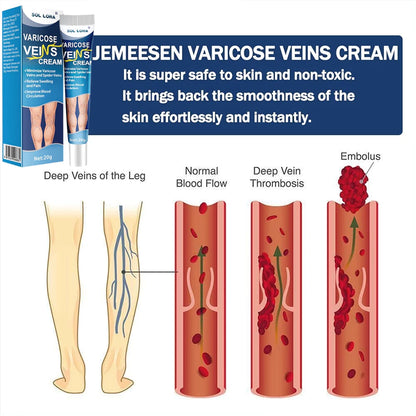 Sol Lora Varicose veins Cream (BUY 1 GET 1 FREE)