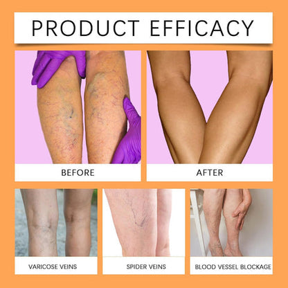 Turmeric Varicose Vein Relief Spray( BUY 1 GET 2 FREE💥 🎁  )
